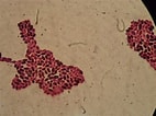 Image result for "chromatonema Rubra". Size: 142 x 106. Source: ar.inspiredpencil.com