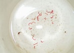 Afbeeldingsresultaten voor Rode draadworm. Grootte: 147 x 106. Bron: www.koiphen.com