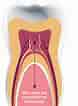 Image result for Dental Pulp cells. Size: 78 x 106. Source: renaissance.com.cy