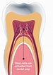 Image result for 3rd Molar dental pulp Cells. Size: 75 x 106. Source: renaissance.com.cy