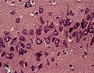Image result for "clathrina Cerebrum". Size: 136 x 106. Source: www.sciencephoto.com