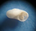 Image result for Skenea serpuloides Anatomie. Size: 121 x 106. Source: www.naturamediterraneo.com