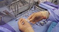 Image result for Plasma Grafting PEG. Size: 198 x 106. Source: www.youtube.com