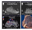 Image result for "cardiapoda Placenta". Size: 115 x 107. Source: www.pinterest.com