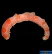 Afbeeldingsresultaten voor Chaetoderma Anatomie. Grootte: 103 x 108. Bron: www.poppe-images.com