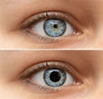 Résultat d’image pour Pupille des yeux. Taille: 114 x 110. Source: www.futura-sciences.com