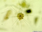 Afbeeldingsresultaten voor "acanthometra Pellucida". Grootte: 147 x 110. Bron: tonysharks.com