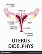 Image result for Uterus Didelphys. Size: 85 x 110. Source: bmp-e.blogspot.com
