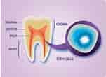 Dental Pulp Stem Cell-साठीचा प्रतिमा निकाल. आकार: 151 x 110. स्रोत: www.oothy.com