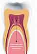 Dental Pulp cells-এর ছবি ফলাফল. আকার: 76 x 110. সূত্র: renaissance.com.cy