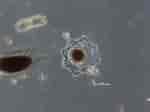 Afbeeldingsresultaten voor "acanthometra Pellucida". Grootte: 150 x 112. Bron: plankton.mio.osupytheas.fr