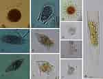 Image result for "tintinnopsis Parvula". Size: 150 x 116. Source: www.researchgate.net