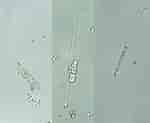 Image result for "salpingella Regulata". Size: 150 x 123. Source: protist.i.hosei.ac.jp
