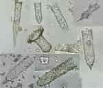Afbeeldingsresultaten voor "Tintinnopsis beroidea". Grootte: 150 x 129. Bron: protist.i.hosei.ac.jp