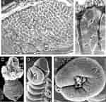 Image result for "nerillidium Gracile". Size: 150 x 144. Source: www.researchgate.net