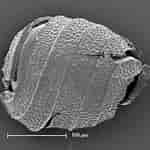 Image result for "pseudochirella Pustulifera". Size: 150 x 150. Source: www.researchgate.net