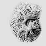 Image result for Granuloreticulosa. Size: 150 x 150. Source: sites.google.com