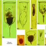 Afbeeldingsresultaten voor "Cymatocylis Vanhoffeni". Grootte: 150 x 150. Bron: www.researchgate.net