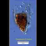 Afbeeldingsresultaten voor "Tintinnopsis beroidea". Grootte: 150 x 150. Bron: gallery.obs-vlfr.fr