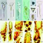 Afbeeldingsresultaten voor "Tintinnopsis beroidea". Grootte: 150 x 150. Bron: www.researchgate.net