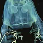 Chiropsalmus quadrumanus Feiten ਲਈ ਪ੍ਰਤੀਬਿੰਬ ਨਤੀਜਾ. ਆਕਾਰ: 150 x 150. ਸਰੋਤ: www.researchgate.net