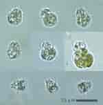 Afbeeldingsresultaten voor "mesodinium Pulex". Grootte: 150 x 152. Bron: protist.i.hosei.ac.jp