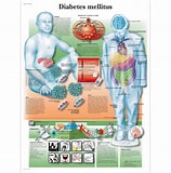 diabetes malletus-साठीचा प्रतिमा निकाल. आकार: 158 x 160. स्रोत: www.3bscientific.com