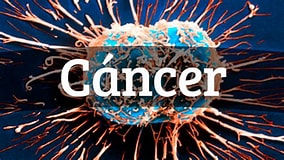 Image result for cáncer. Size: 284 x 160. Source: gnosisconocimientodivinal.blogspot.com