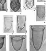 Image result for "Codonellopsis Pusilla". Size: 150 x 166. Source: www.researchgate.net