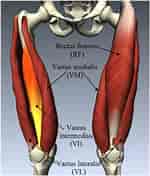 Image result for Musculus Quadratus femoris. Size: 150 x 176. Source: www.researchgate.net