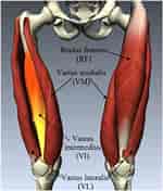 Image result for Musculus Quadriceps femoris. Size: 150 x 176. Source: www.mikrora.com