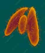 Image result for "Protocystis Tridens". Size: 150 x 177. Source: www.sciencephoto.com