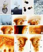 Image result for "Codonellopsis Pusilla". Size: 150 x 178. Source: www.researchgate.net