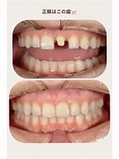 スマイルヒルズ中目黒歯科 に対する画像結果