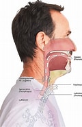 Bildergebnis für Submuköses Hämangiom der subglottischen trachea. Größe: 120 x 185. Quelle: www.fahl.com