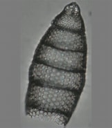 Image result for "eucyrtidium Acuminatum". Size: 162 x 185. Source: www.mikrotax.org