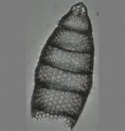 Image result for "eucyrtidium Acuminatum". Size: 177 x 185. Source: www.mikrotax.org
