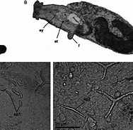 Afbeeldingsresultaten voor Microhedyle. Grootte: 188 x 185. Bron: www.researchgate.net