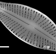 Afbeeldingsresultaten voor "phorticium Clevei". Grootte: 192 x 185. Bron: diatoms.org