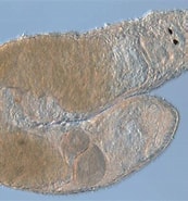 Image result for Dolichomacrostomidae. Size: 173 x 185. Source: alchetron.com
