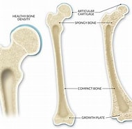 Image result for Osteogenesis Imperfecta � Glasknochenerkrankung. Size: 190 x 185. Source: www.boneandjointdisordershub.com