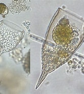 Image result for "Epiplocylis undella". Size: 166 x 185. Source: protist.i.hosei.ac.jp