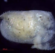 Image result for "conchoecia Hyalophyllum". Size: 189 x 185. Source: www.marinespecies.org