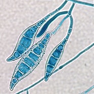 Afbeeldingsresultaten voor "sethodiscus Macrococcus". Grootte: 186 x 185. Bron: microculture.tumblr.com