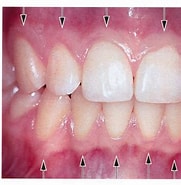 鄭淑敏牙周病專科 的圖片結果. 大小：181 x 185。資料來源：periojehng.com