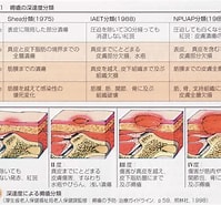 訪問看護褥瘡マニュアル に対する画像結果.サイズ: 199 x 185。ソース: ameblo.jp