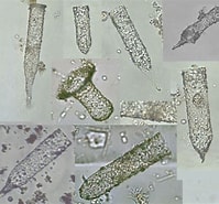 Image result for "tintinnopsis Kofoidi". Size: 199 x 185. Source: protist.i.hosei.ac.jp
