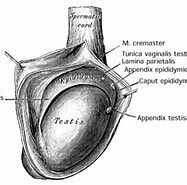 Image result for Hoden Sternenhimmelphänomen. Size: 187 x 185. Source: www.urologielehrbuch.de