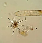 Image result for "acanthometra Pellucida". Size: 181 x 185. Source: www.youtube.com