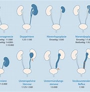 Image result for Transiente Kortikomedullaere Echogenitaetserhoehung der Neugeborenen-niere. Size: 180 x 185. Source: link.springer.com